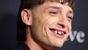 Cuando sonrió para las fotos, muchos notaron algo extraño.