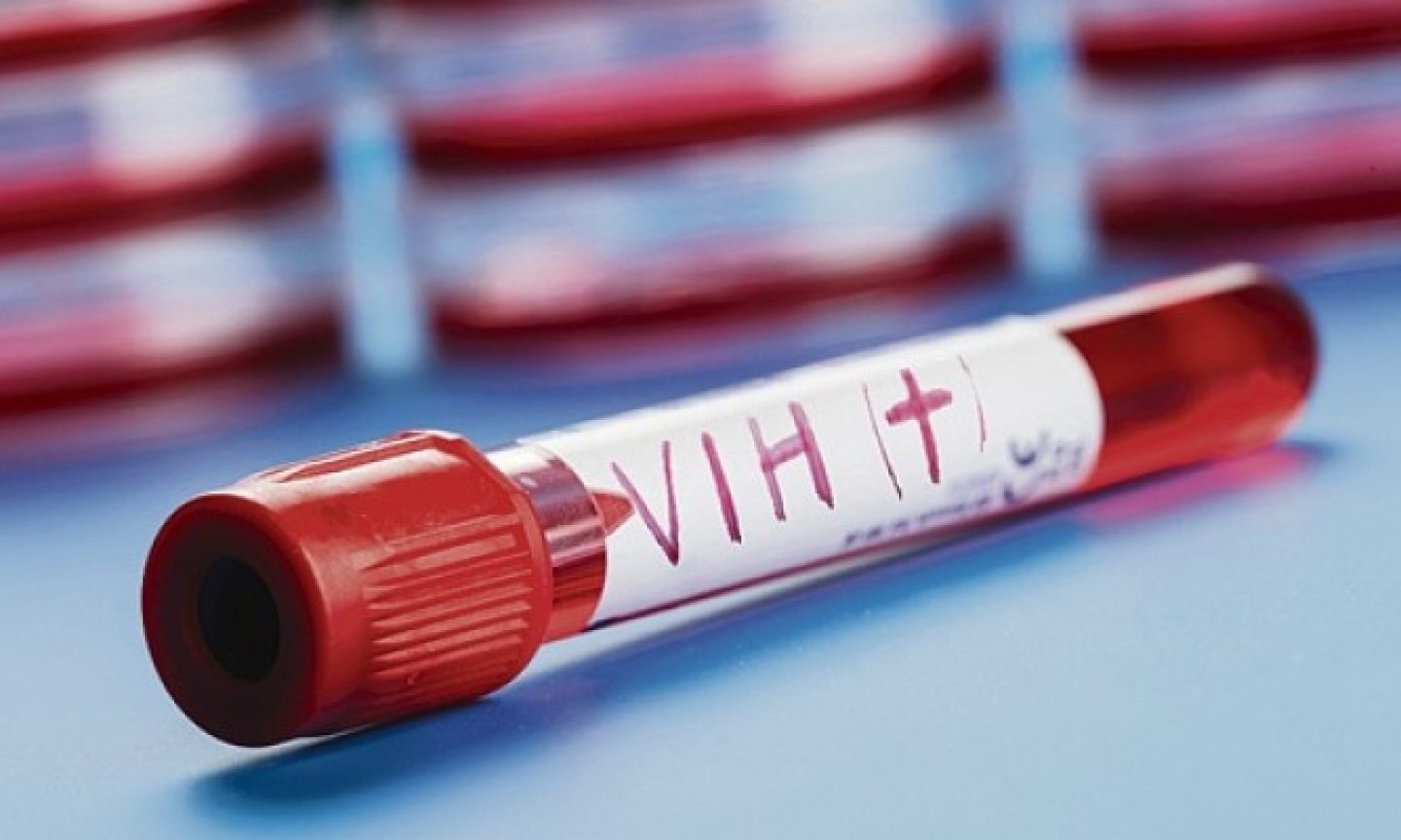 Ministerio de Salud advierte que los casos de VIH aumentaron un 96% desde 2010
