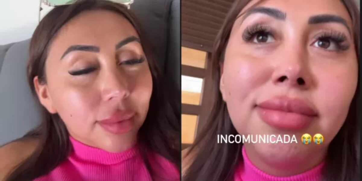 Naya Fácil tras apagón