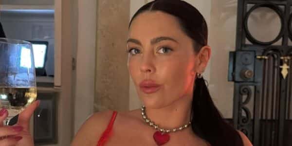 Daniela Aránguiz mostrando su rostro tras tratamiento estético