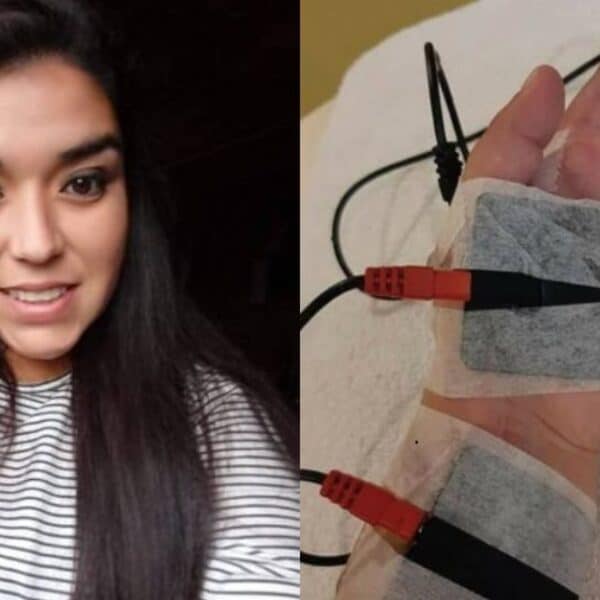 Víctima de ataque con hacha en Puerto Montt denunció amenazas tras liberación de agresor