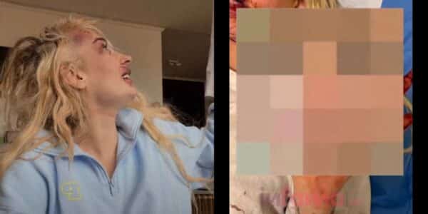 Fran Maira aparece con el rostro lesionado después de denunciar una golpiza
