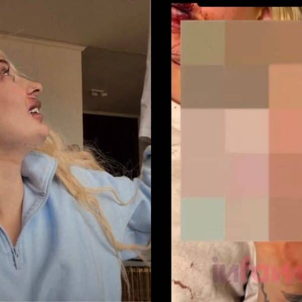 Fran Maira aparece con el rostro lesionado después de denunciar una golpiza