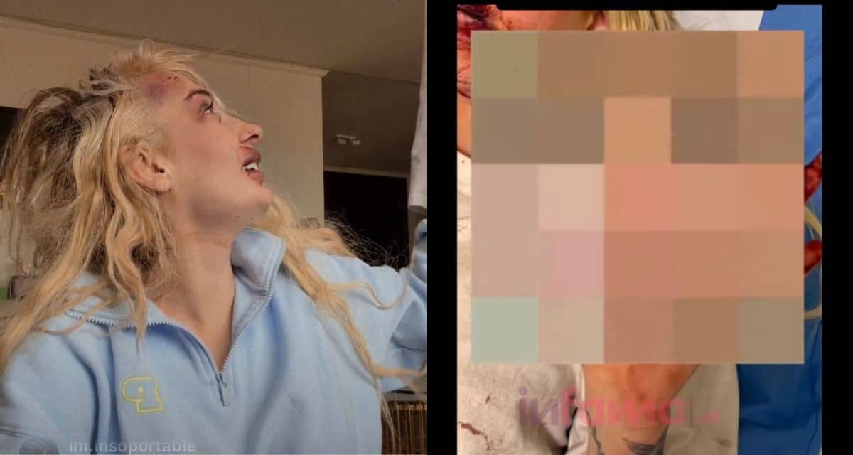 Fran Maira aparece con el rostro lesionado después de denunciar una golpiza