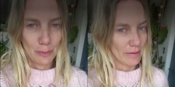 Javiera Acevedo realiza desesperado llamado en redes sociales para conseguir donantes de sangre para su perro Negrito