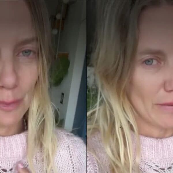 Javiera Acevedo realiza desesperado llamado en redes sociales para conseguir donantes de sangre para su perro Negrito