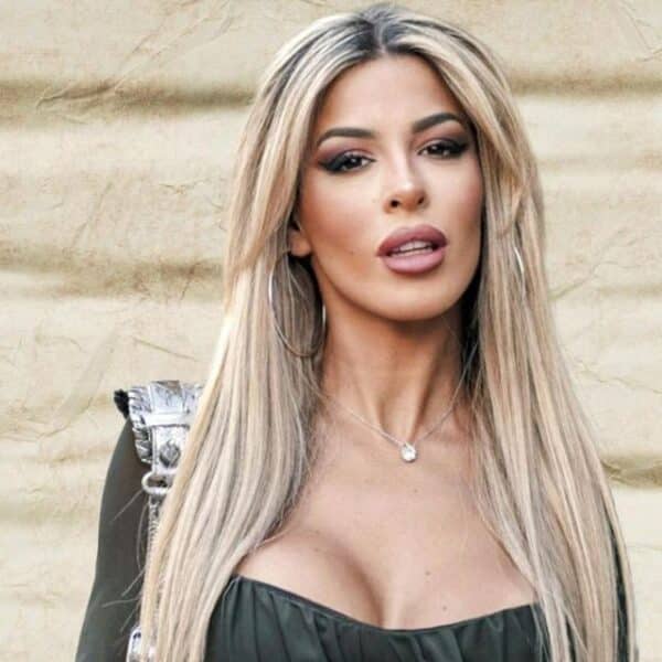 Oriana Marzoli luce su rostro tras someterse a un lifting Reina Nefertiti en Santiago