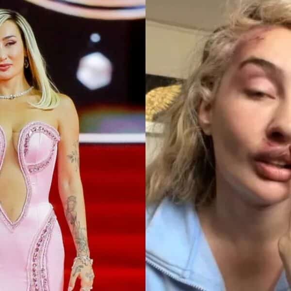 Fran Maira se encuentra internada por estrés agudo después del episodio de violencia que denunció