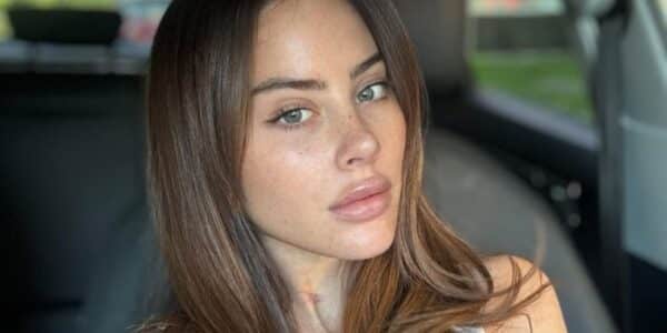 Ignacia Michelson muestra su nueva sonrisa.