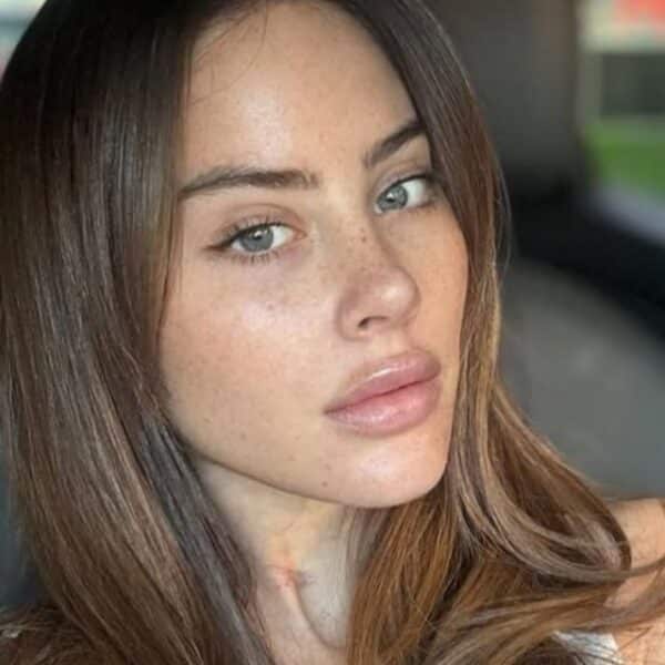 Ignacia Michelson muestra su nueva sonrisa.
