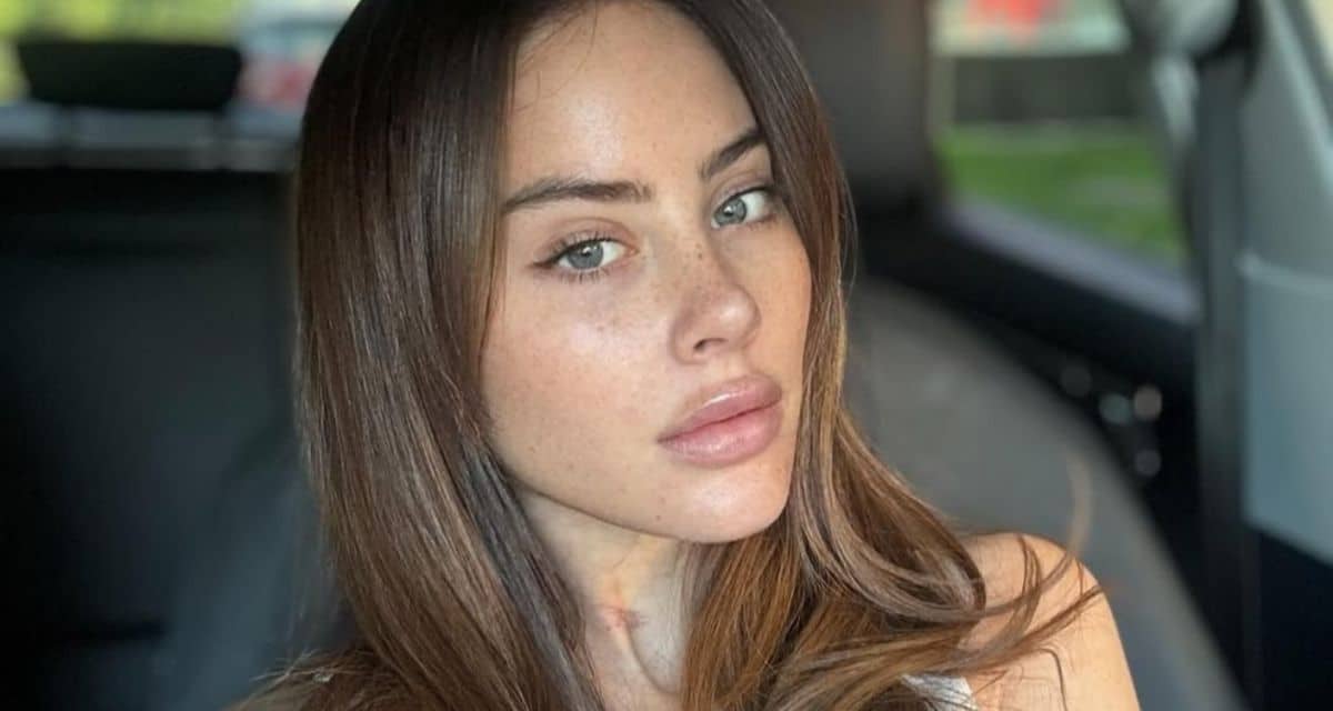 Ignacia Michelson muestra su nueva sonrisa.