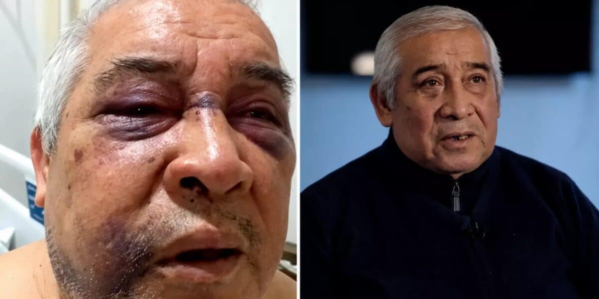 Conserje agredido por Martín de los Santos.