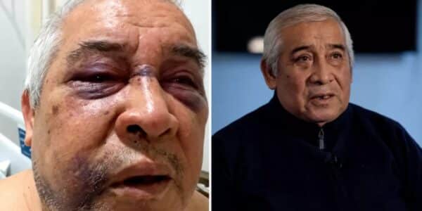 Conserje agredido por Martín de los Santos.