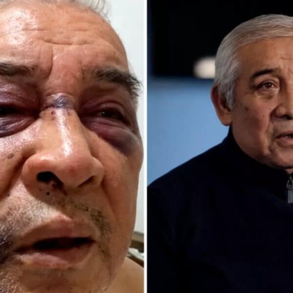 Conserje agredido por Martín de los Santos.