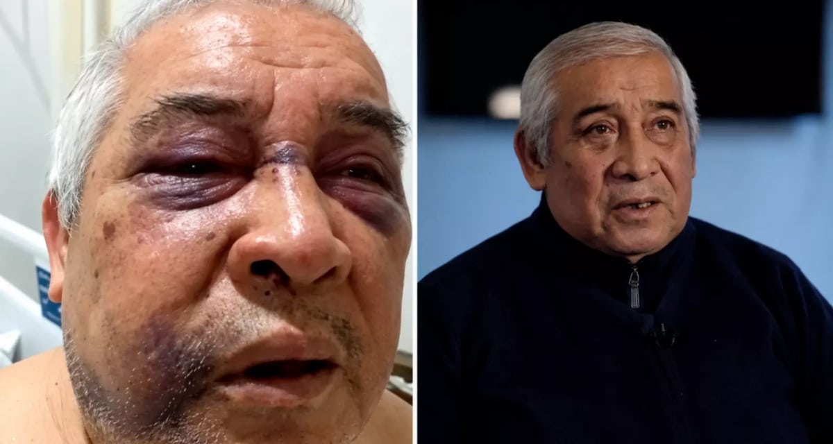 Conserje agredido por Martín de los Santos.