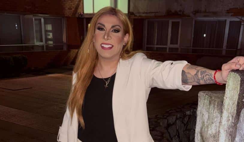 Botota Fox reveló el nuevo procedimiento que se realizó en el rostro | Crédito: Instagram @ labototafox