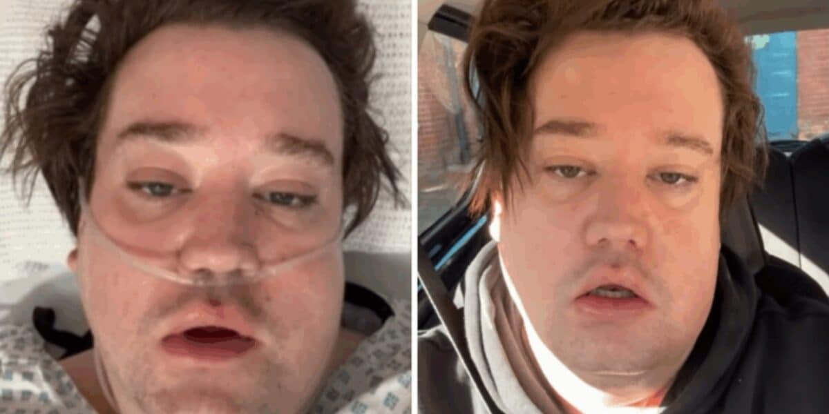 Nicolás Yunge, ex integrante de Perla, contó que estuvo en coma inducido en la UCI de un hospital de Londres tras una complicación por un quiste en la mandíbula