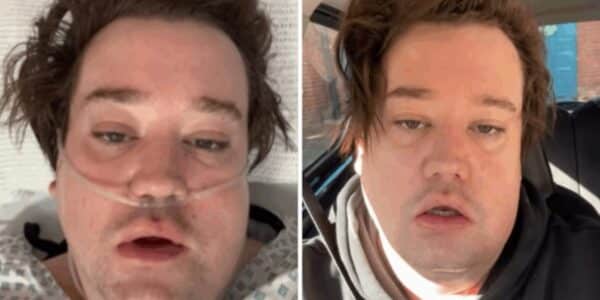 Nicolás Yunge, ex integrante de Perla, contó que estuvo en coma inducido en la UCI de un hospital de Londres tras una complicación por un quiste en la mandíbula