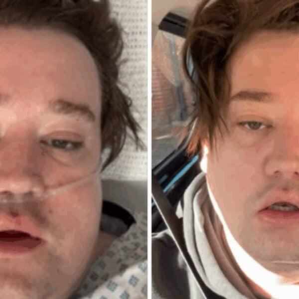 Nicolás Yunge, ex integrante de Perla, contó que estuvo en coma inducido en la UCI de un hospital de Londres tras una complicación por un quiste en la mandíbula