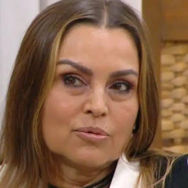 Yasmín Valdés muestra su rostro tras someterse a un procedimiento estético.